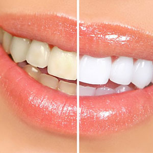 For Cosmetic Dentistry Choose Oak Springs Dental in Miami Lakes For Cosmetic Dentistry Choose Oak Springs Dental in Miami Lakes